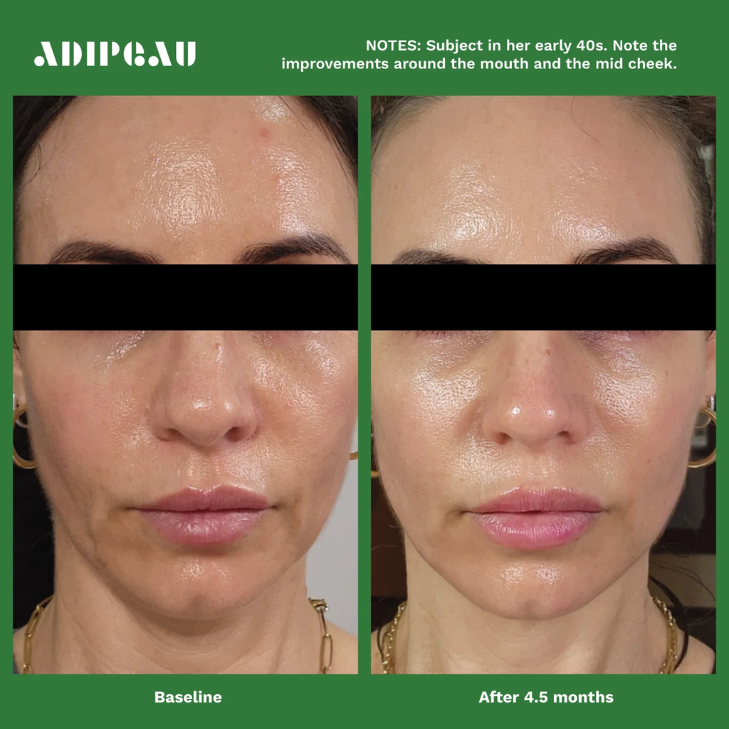 Volume Cream